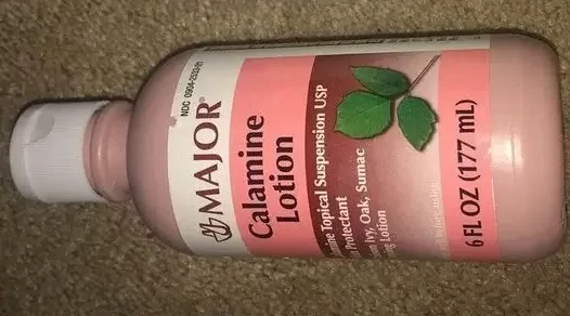 calamine lotion to treat bed bug bites